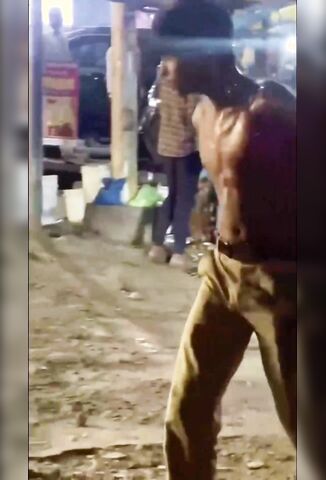 Man Gets Boiling Oil Thrown Over Him During Market Dispute