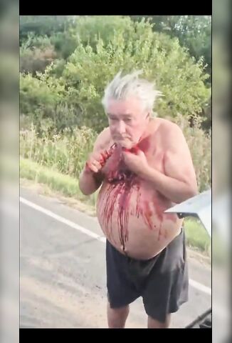 Fatman Cuts Himself At The Roadside