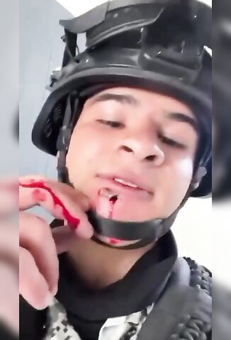 Mexican Officer Took A Round To The Chin During The Killing Of El Mencho