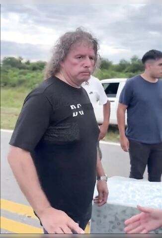 Argentinian Politicians Nose Explodes After Headbutt From Agitator