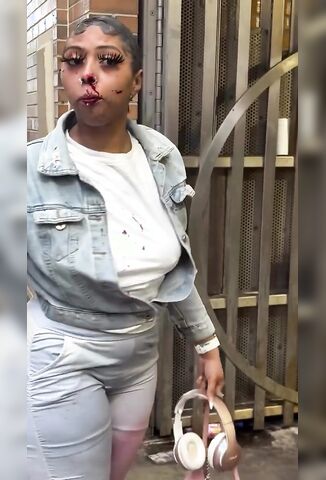 I Think She Was Beaten For Being Dressed Like That