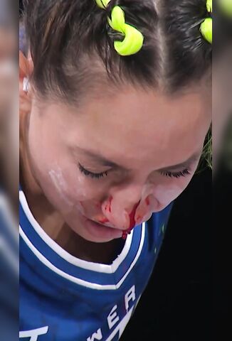First Her Tooth Then Her Nose